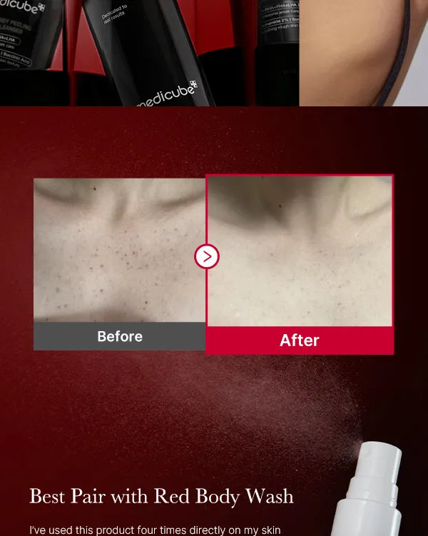 Medicube Red Acne Body Peeling Shot – 110g