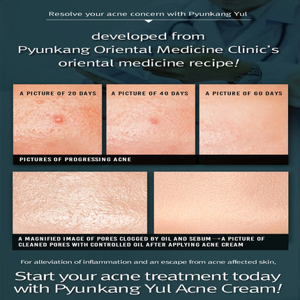 Pyunkang Yul Acne Cream 50ml