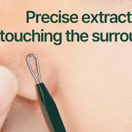 Pyunkang Yul - Pimple Extractor, estuche de estaño incluido, herramientas extractoras para eliminación de espinillas en la cara