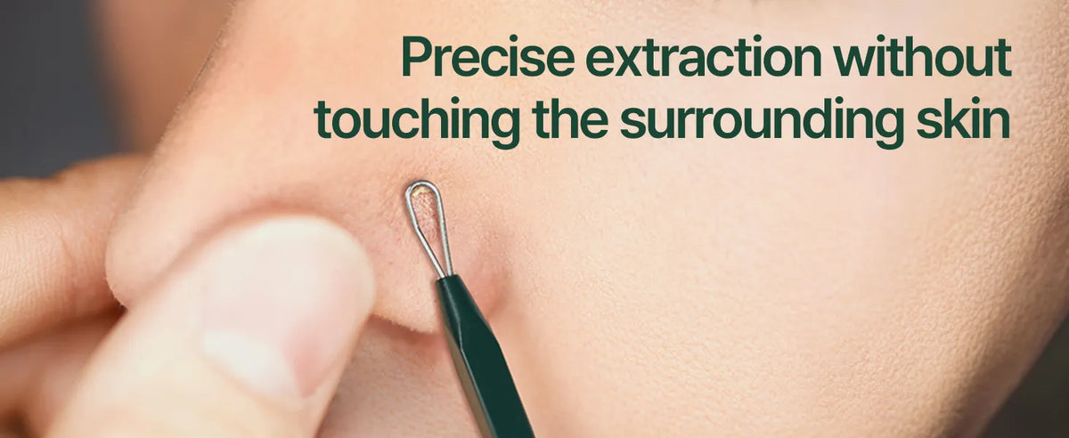 Pyunkang Yul - Pimple Extractor, estuche de estaño incluido, herramientas extractoras para eliminación de espinillas en la cara