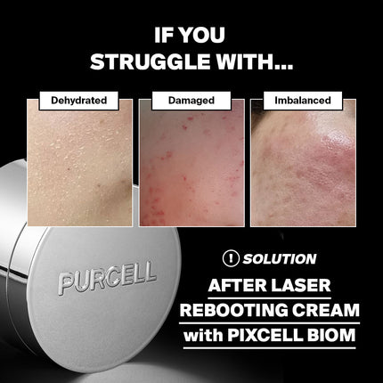 Purcell Pixcell Biom™ After Rebooting Cream 50 ml