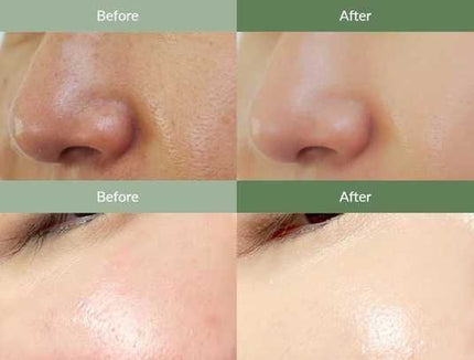 Dr.Althea Premium Quick Step Sebum Cleanser Limpiador de sebo