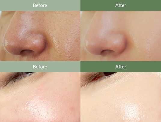 Dr.Althea Premium Quick Step Sebum Cleanser Limpiador de sebo