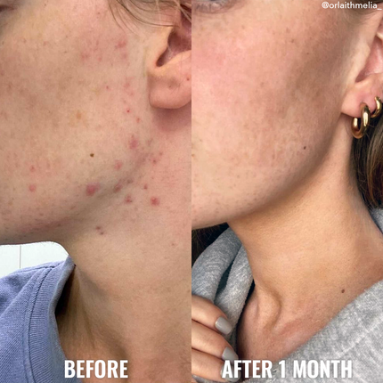 Good Molecules Serum Niacinamida- Texture & Pores