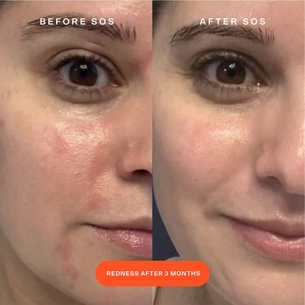 Torre 28 Mini Spray Facial SOS Daily Rescue con Ácido Hipocloroso 120 ml