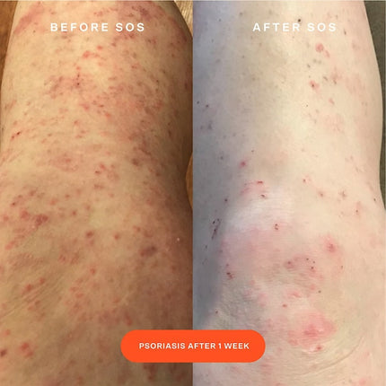 Torre 28 Mini Spray Facial SOS Daily Rescue con Ácido Hipocloroso 120 ml