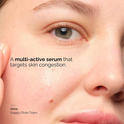 The Ordinary Balancing & Clarifying Serum -Suero equilibrante y aclarante para pieles con imperfecciones