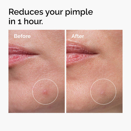 The Ordinary Sulfur 10% Powder-to-Cream Tratamiento localizado para el acné