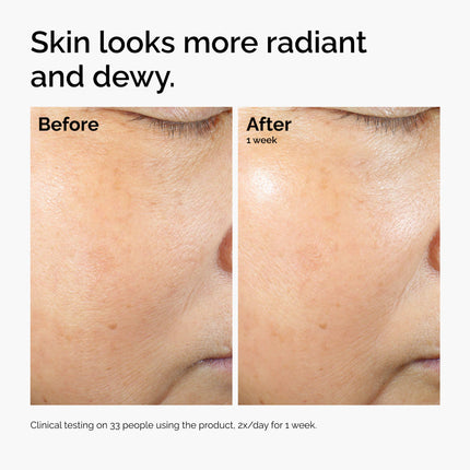 The ordinary Rice Lipids + Ectoin Microemulsion Moisturizer for Soothing Hydration & Reduced Redness 60ml