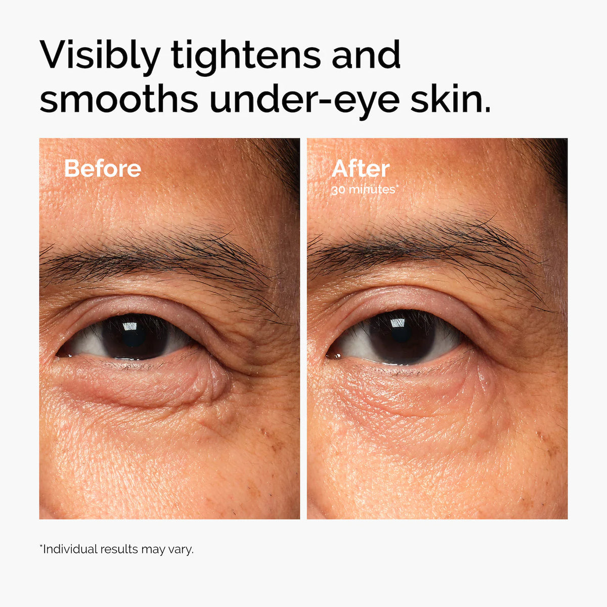 The Ordinary  Lacto-PDRN* 4% + B9 Eye Cream 15ml