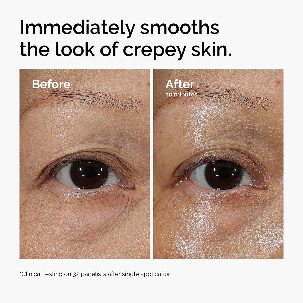 The Ordinary  Lacto-PDRN* 4% + B9 Eye Cream 15ml