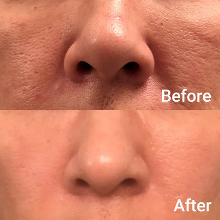 medicube - Zero Pore Pad 2.0 70 pads